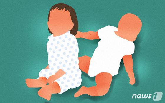 제주서 성홍열 의심환자 3명 발생…"역학조사 중"