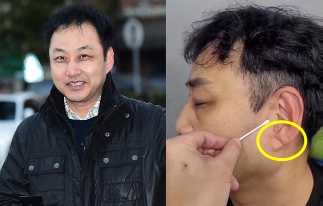 "귓불에 대각선 깊은 주름이"…의식 잃은 김수용, 전조 증상이었나