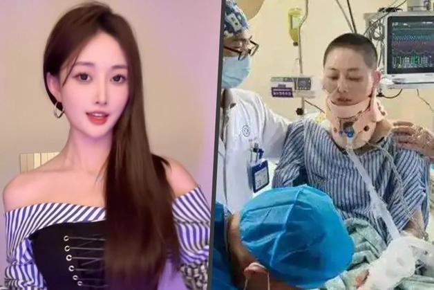 "35층 추락, 생존"…오른쪽 다리 잃은 27세 인플루언서 17개월 만에 컴백