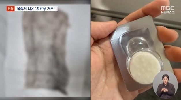 자궁 시술 후 손바닥만 한 거즈가 몸속에…제거 안 한 의사는 '무혐의'