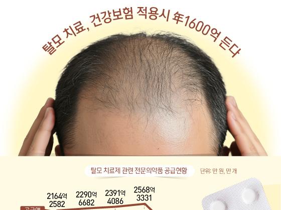 탈모 치료, 건강보험 적용시 年1600억 든다