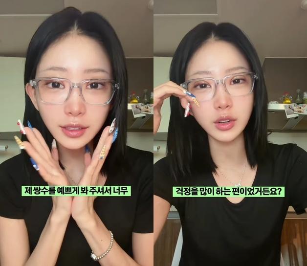 '최진실 딸' 최준희, 세 번째 쌍꺼풀 수술 "엄마와 달리 난 인조적" [N샷]